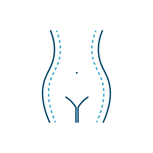 Define tu figura con liposucción en Madrid en la clínica del Dr. Franco Góngora. Elimina michelines en cintura, abdomen y flancos
