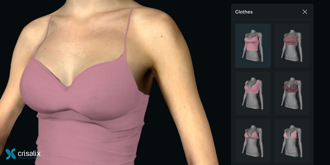 Visualización de prendas tras aumento de pecho en app Crisalix